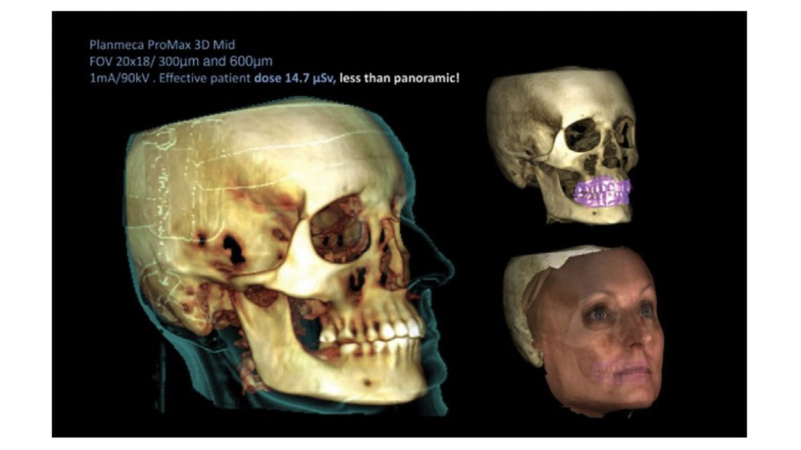 Отоларингологическая 3D-рентгеновская система Planmeca ProMax 3D Mid